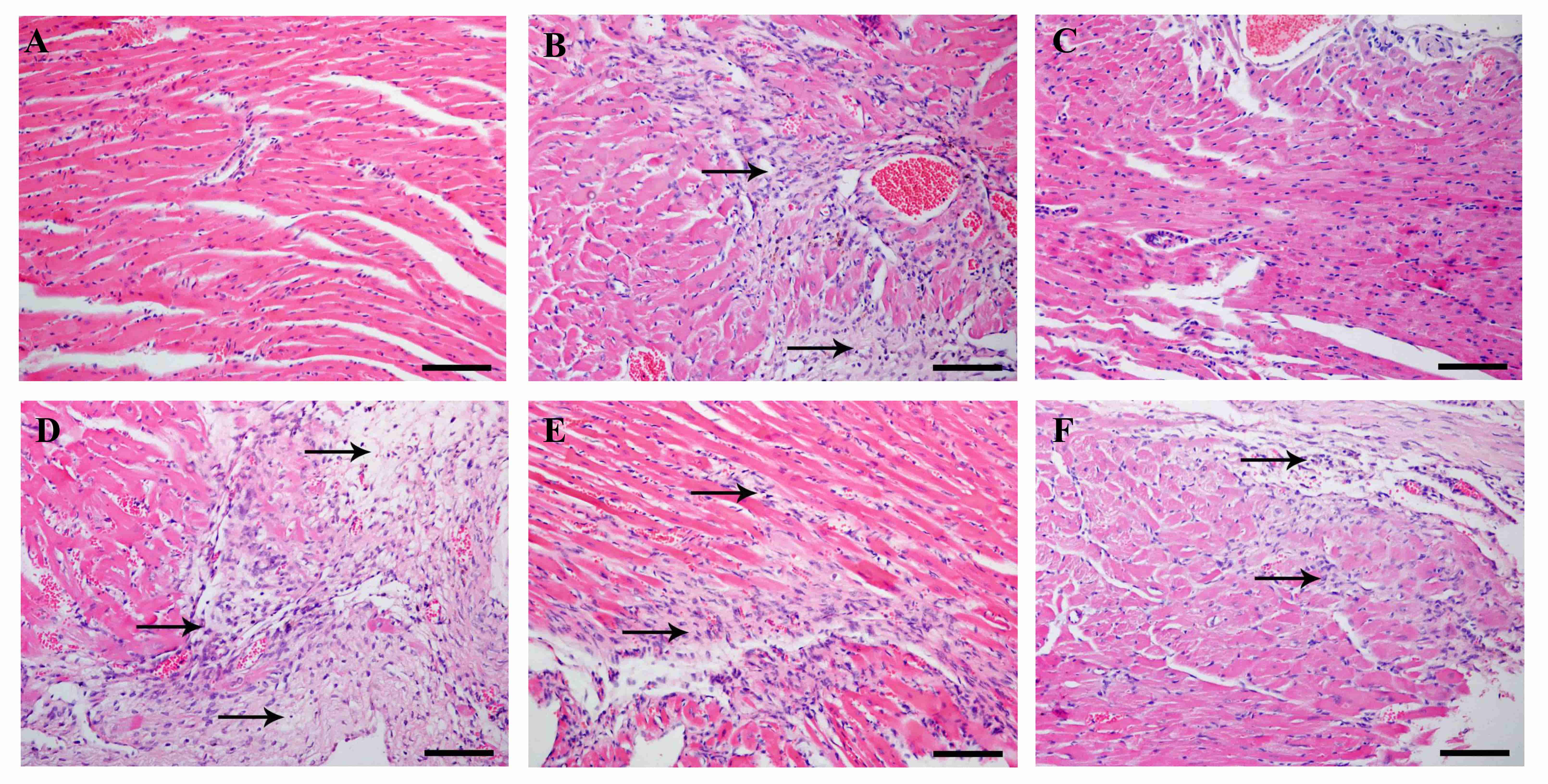 Exploration of the active components and pharmacological mechanism of Compound Longmaining for the treatment of myocardial infarction Exploration of the active components and pharmacological mechanism of Compound Longmaining for the treatment of myocardial infarction