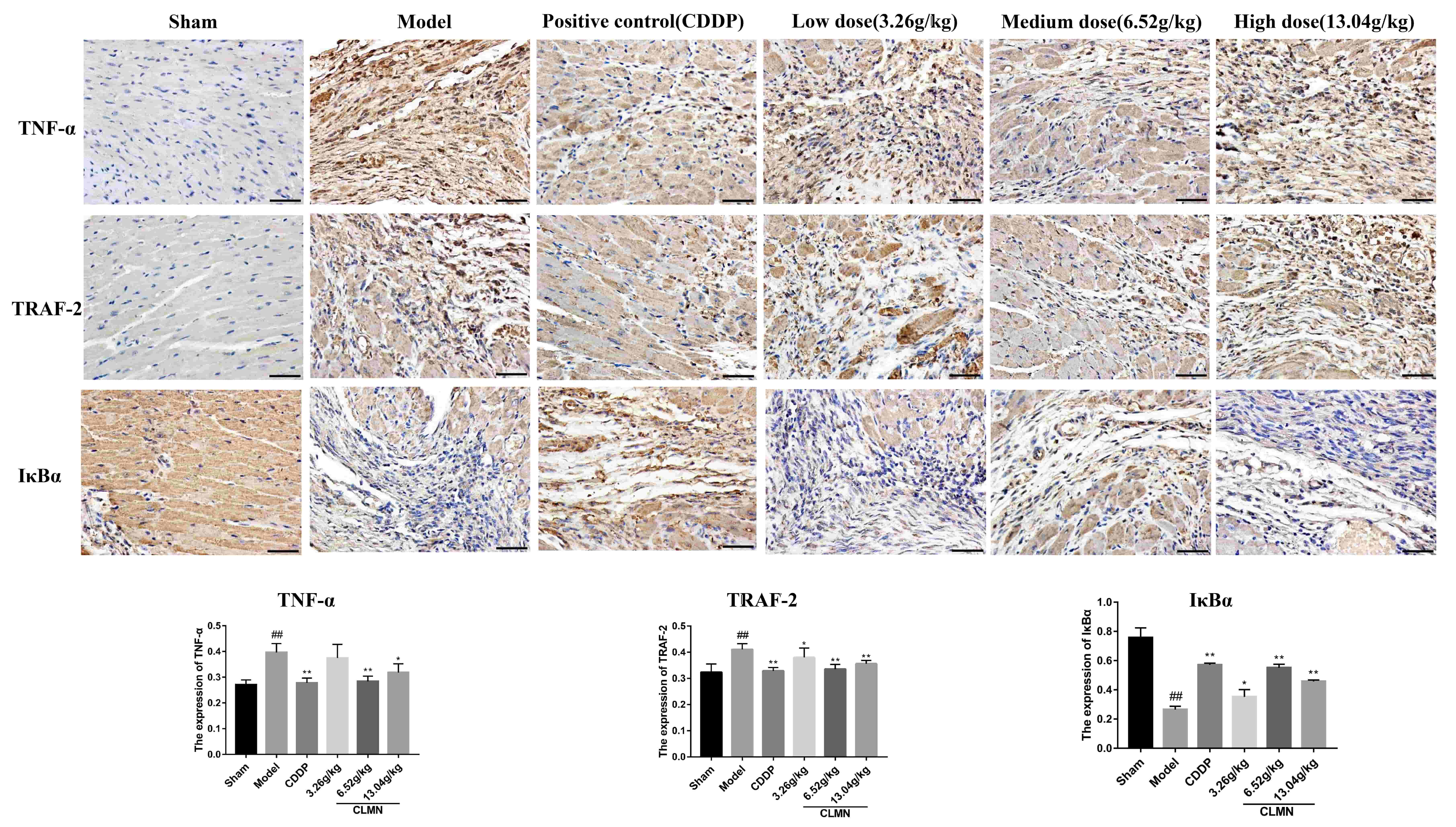Exploration of the active components and pharmacological mechanism of Compound Longmaining for the treatment of myocardial infarction Exploration of the active components and pharmacological mechanism of Compound Longmaining for the treatment of myocardial infarction