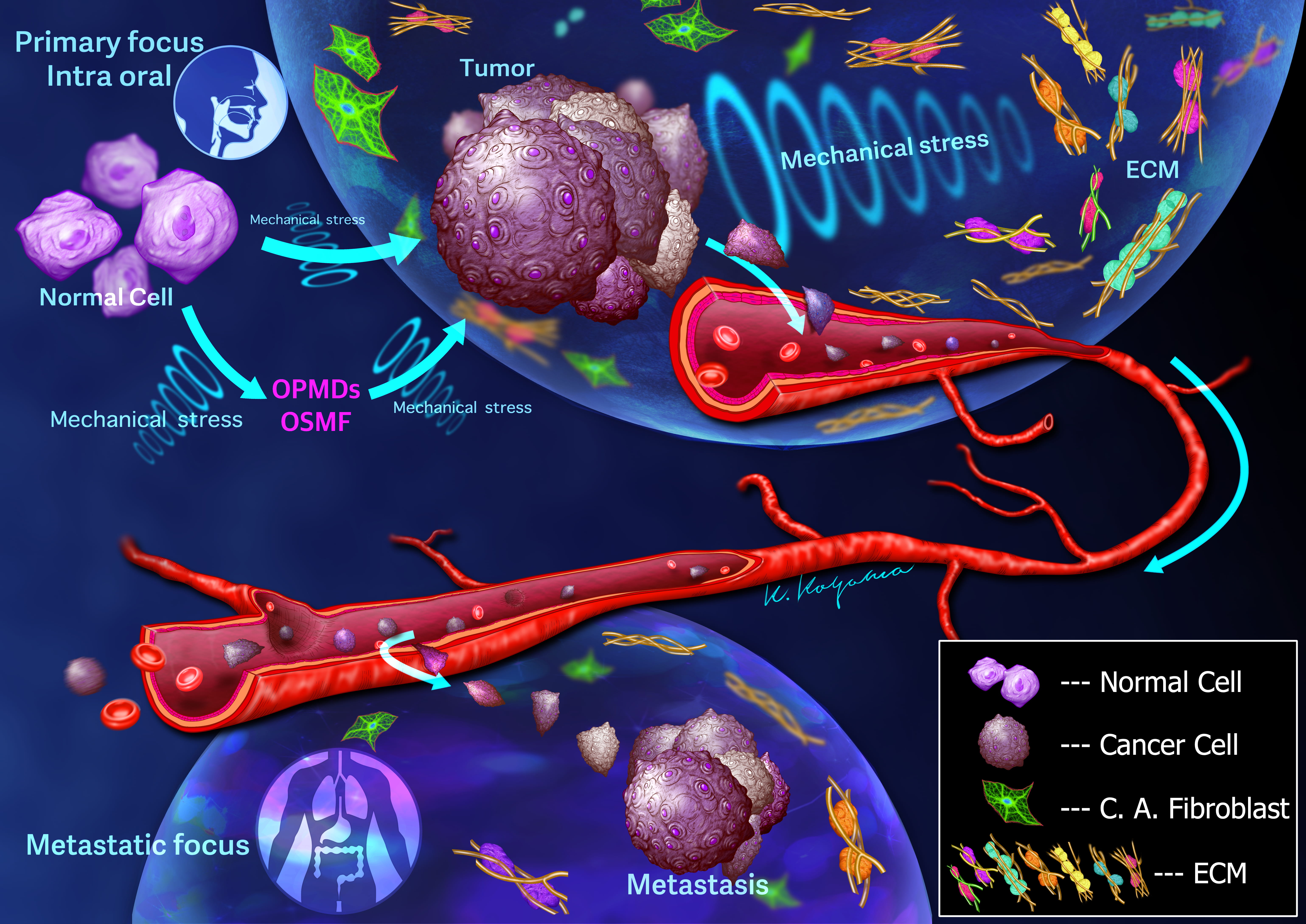 Basement membrane stiffness determines metastases formation