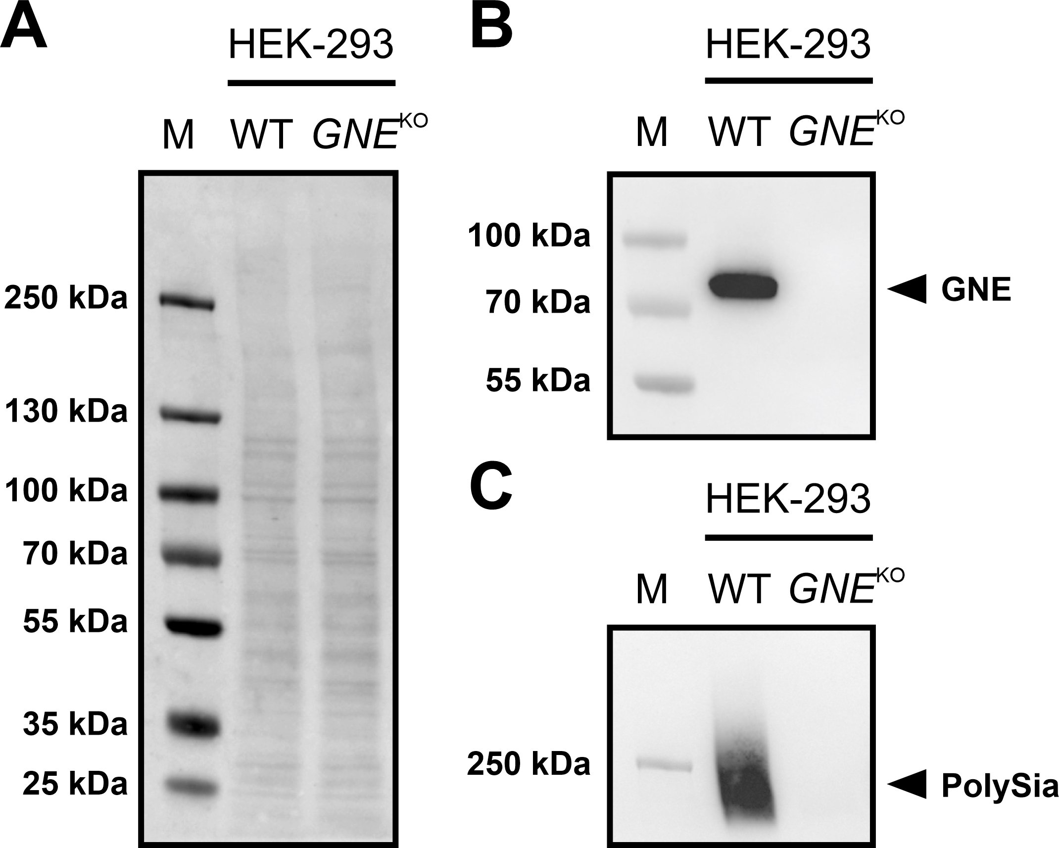 Evaluation of N-Acetylmannosamine Administration to Restore Sialylation ...