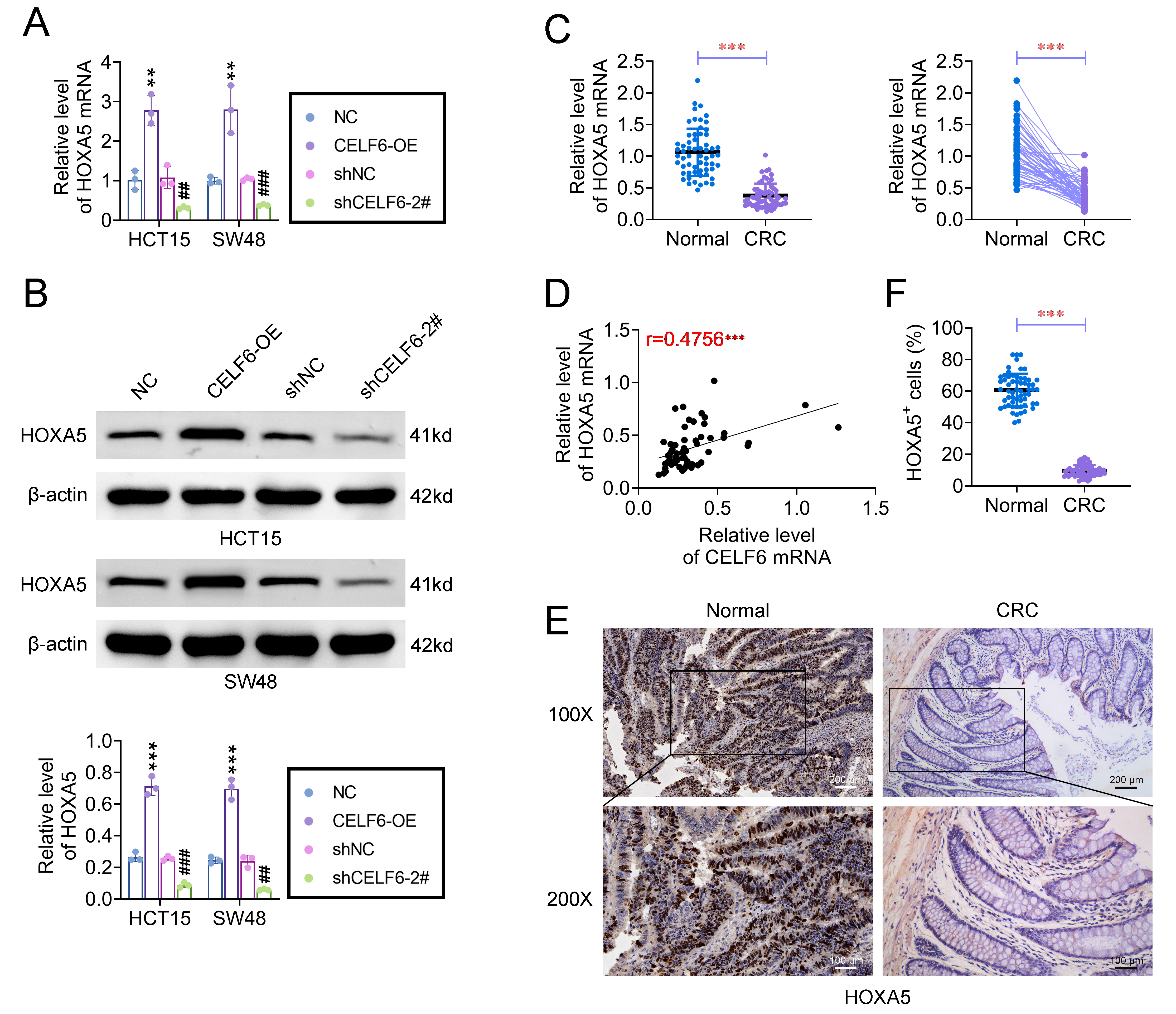 CELF6 as an Oncogene in Colorectal Cancer: Targeting Stem