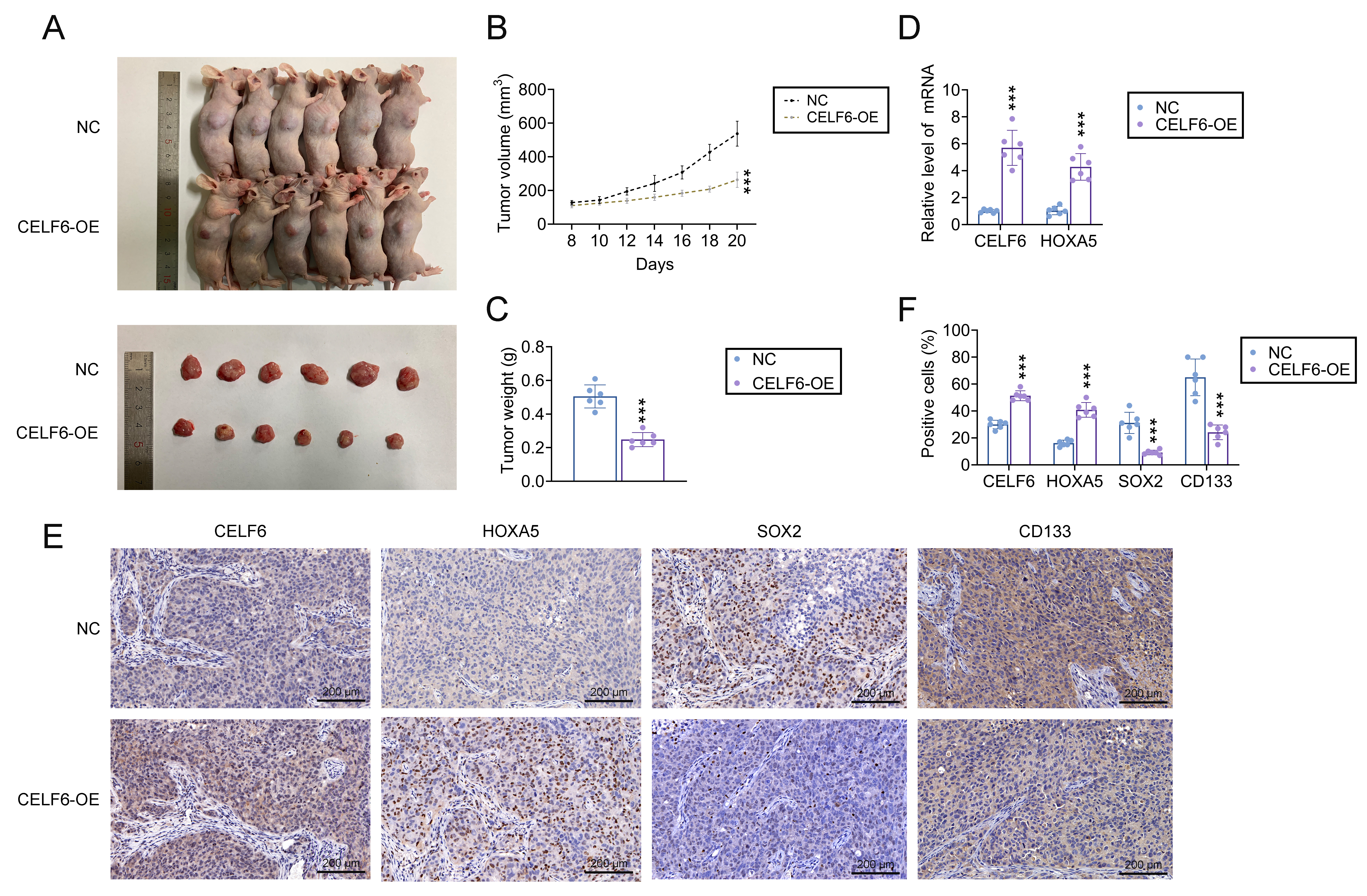 おまとめ【cal224 206　fl613　aph65　heu5　sel3】 CELF6 as an Oncogene in Colorectal Cancer: Targeting Stem