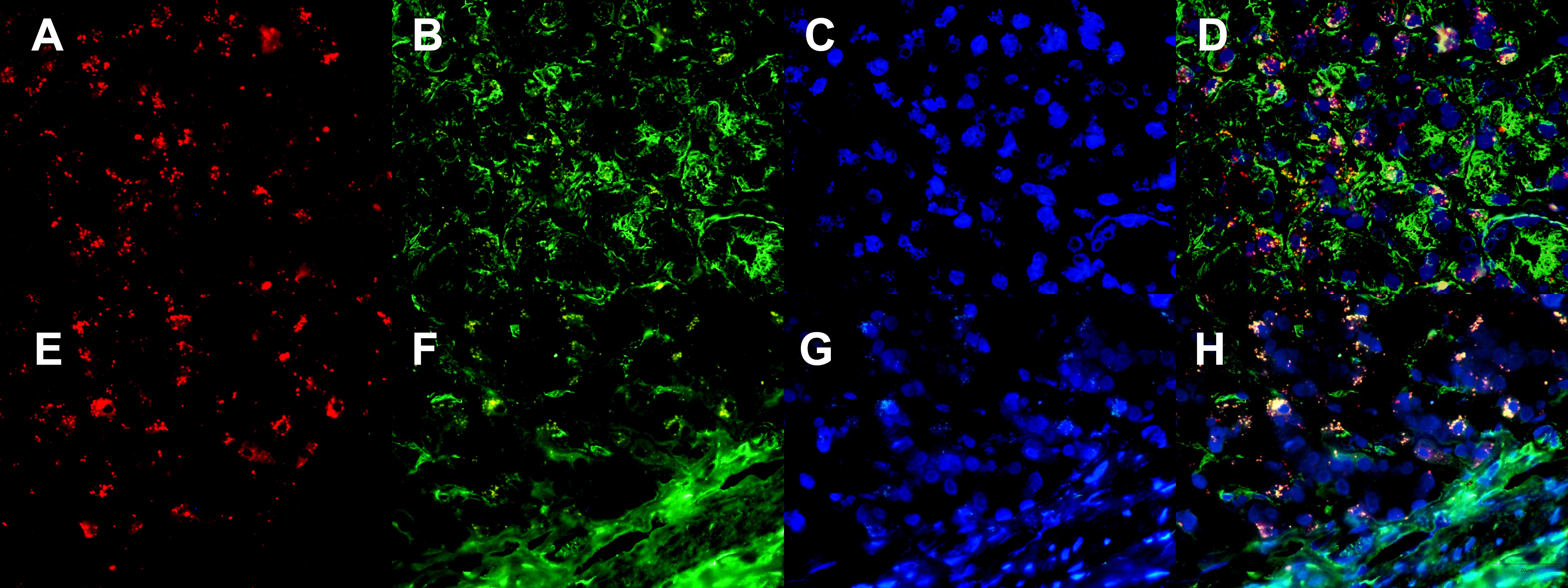 Histopathological and Immunohistochemical Mechanisms of Bone Marrow ...