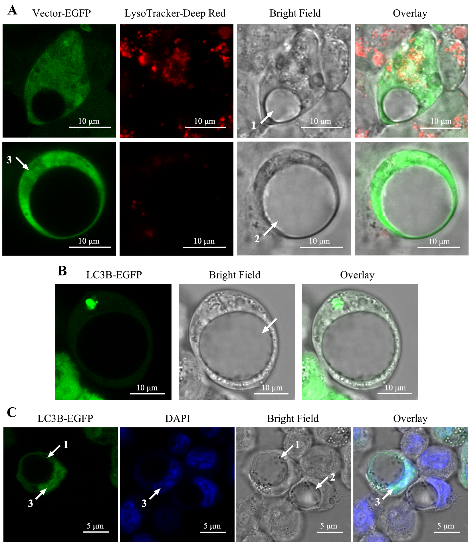 The Formation and Features of Massive Vacuole Induced by