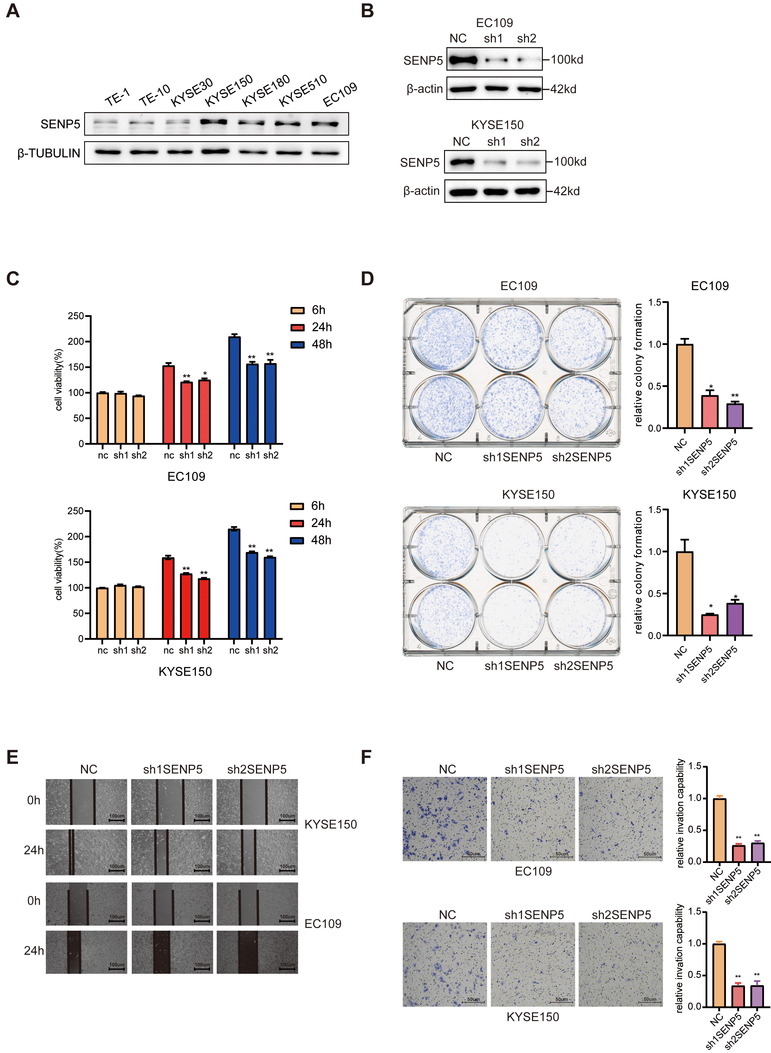 SUMO-Specific Peptidase 5 Promotes Oesophageal Squamous Cell