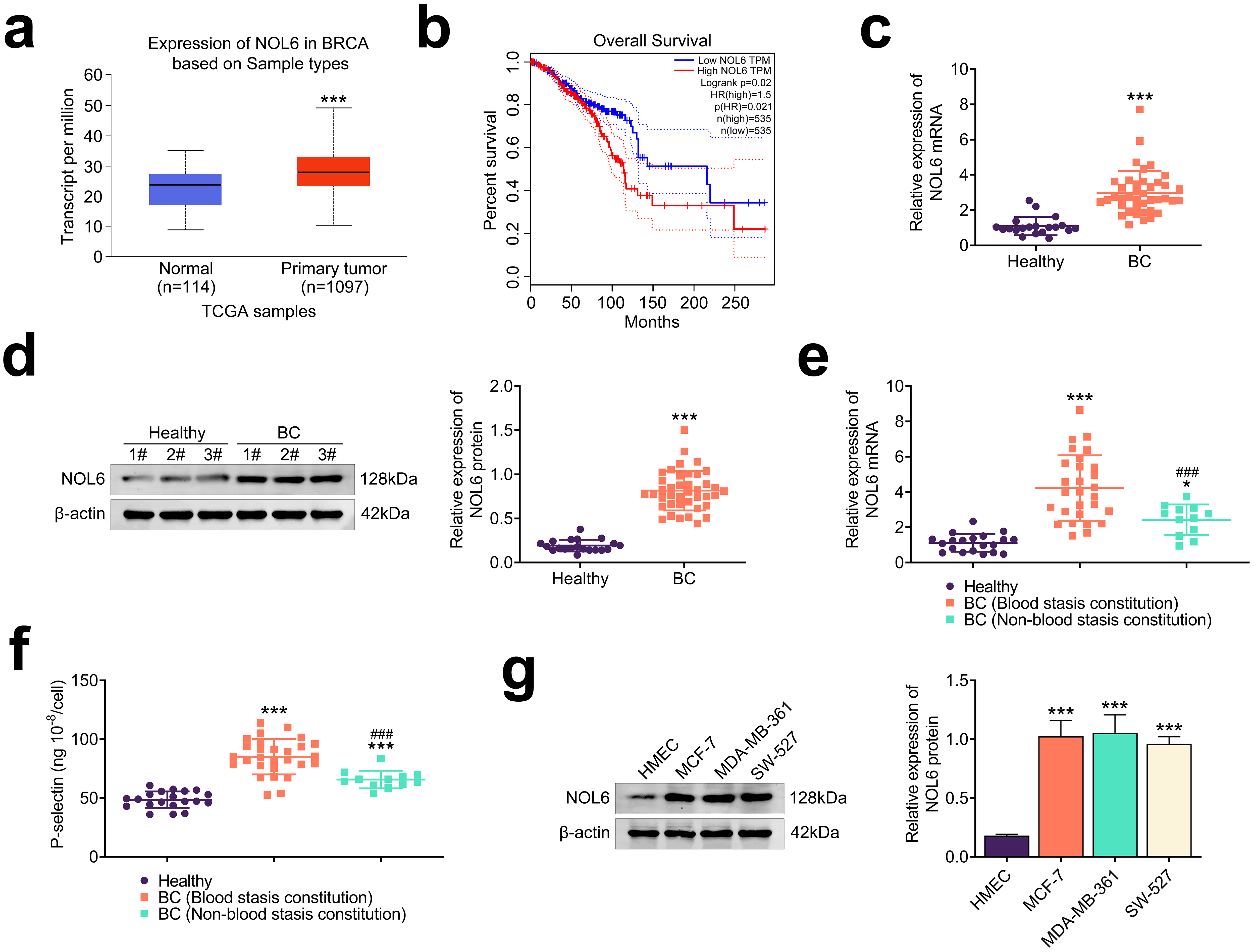 NOL6 Promotes Tumor Progression by Facilitating Cancer Cell