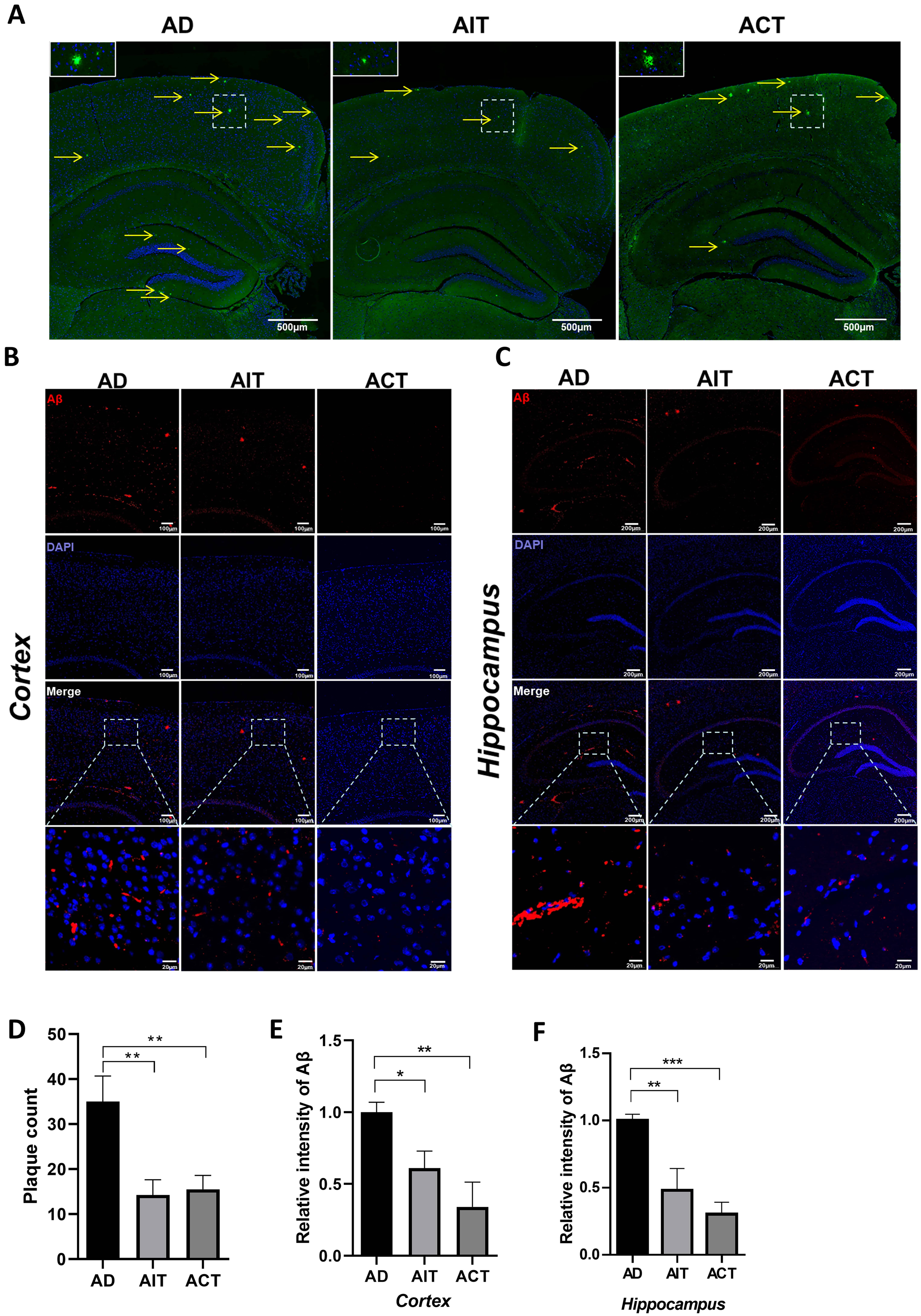 Aerobic Exercise Ameliorates Alzheimer's Disease-Like