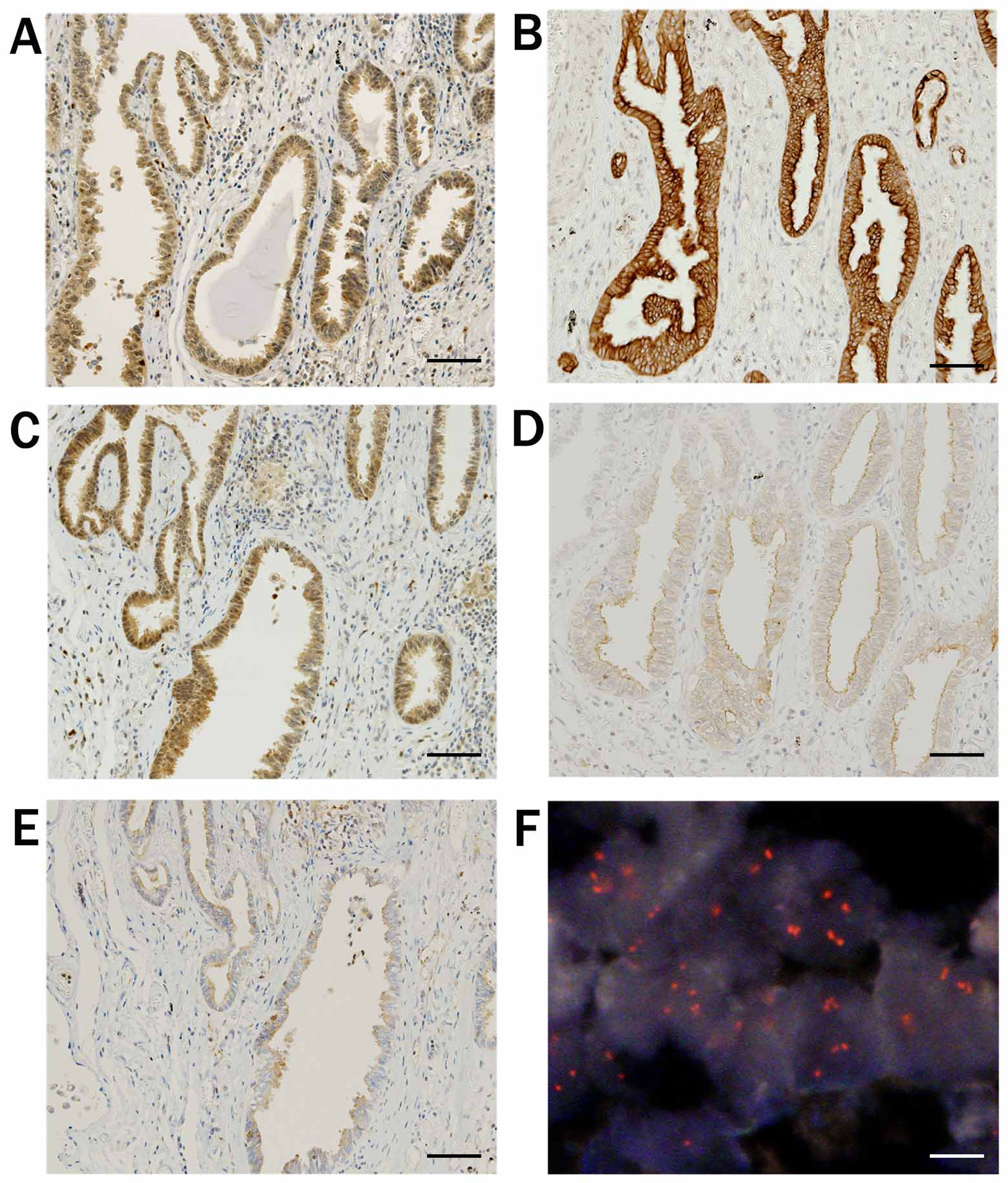 AKT: A Central Node in Complex Signaling Cascades