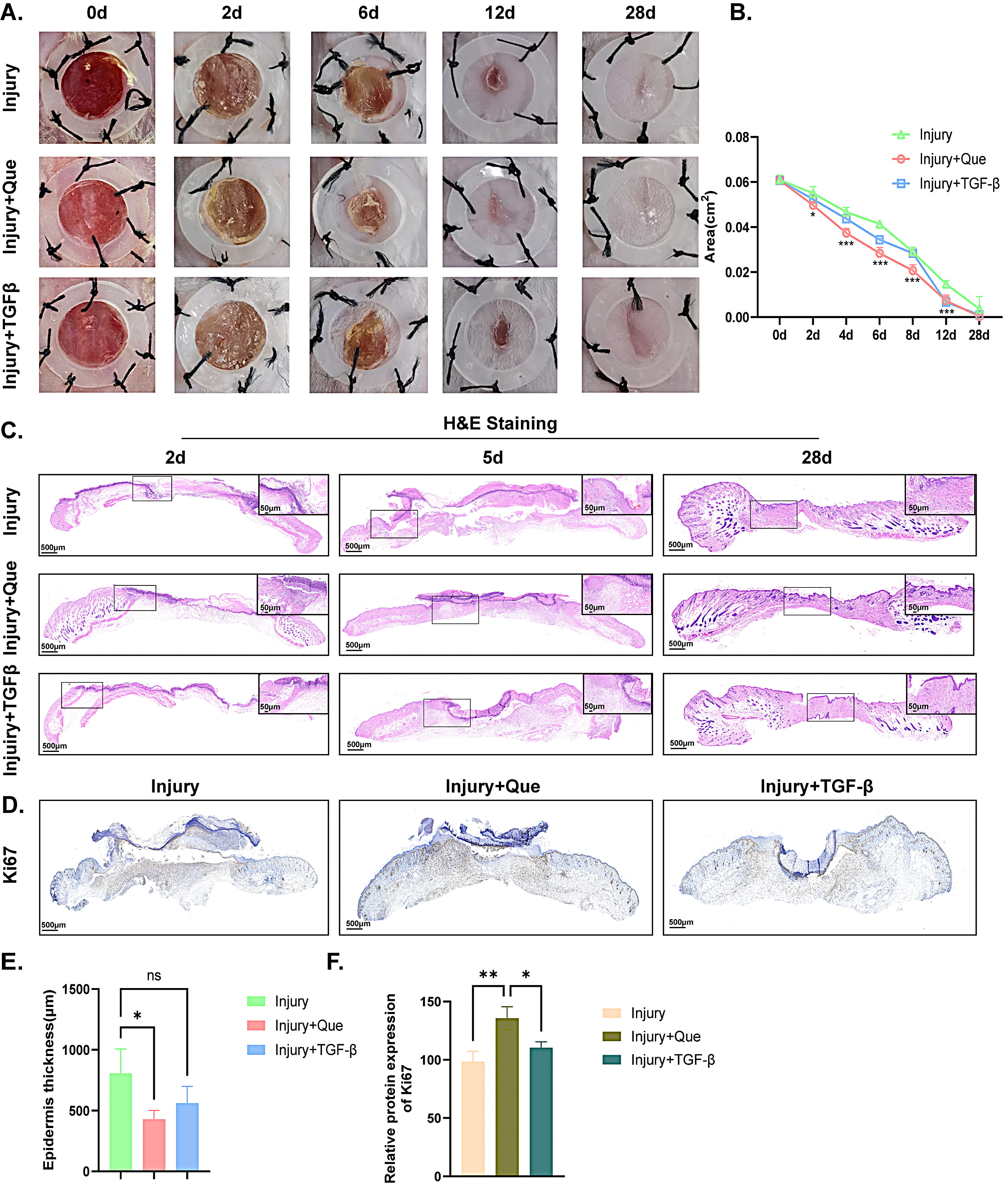 Dual Role of Quercetin in Promoting Early Wound Healing via