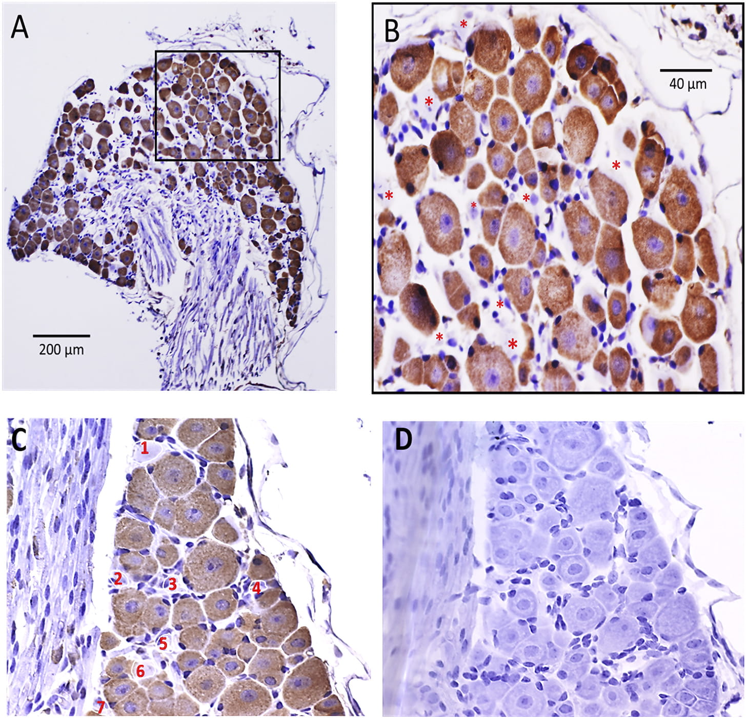 https://article.imrpress.com/journal/JIN/20/4/10.31083/j.jin2004085/1757-448X-20-4-825/fig1.jpg