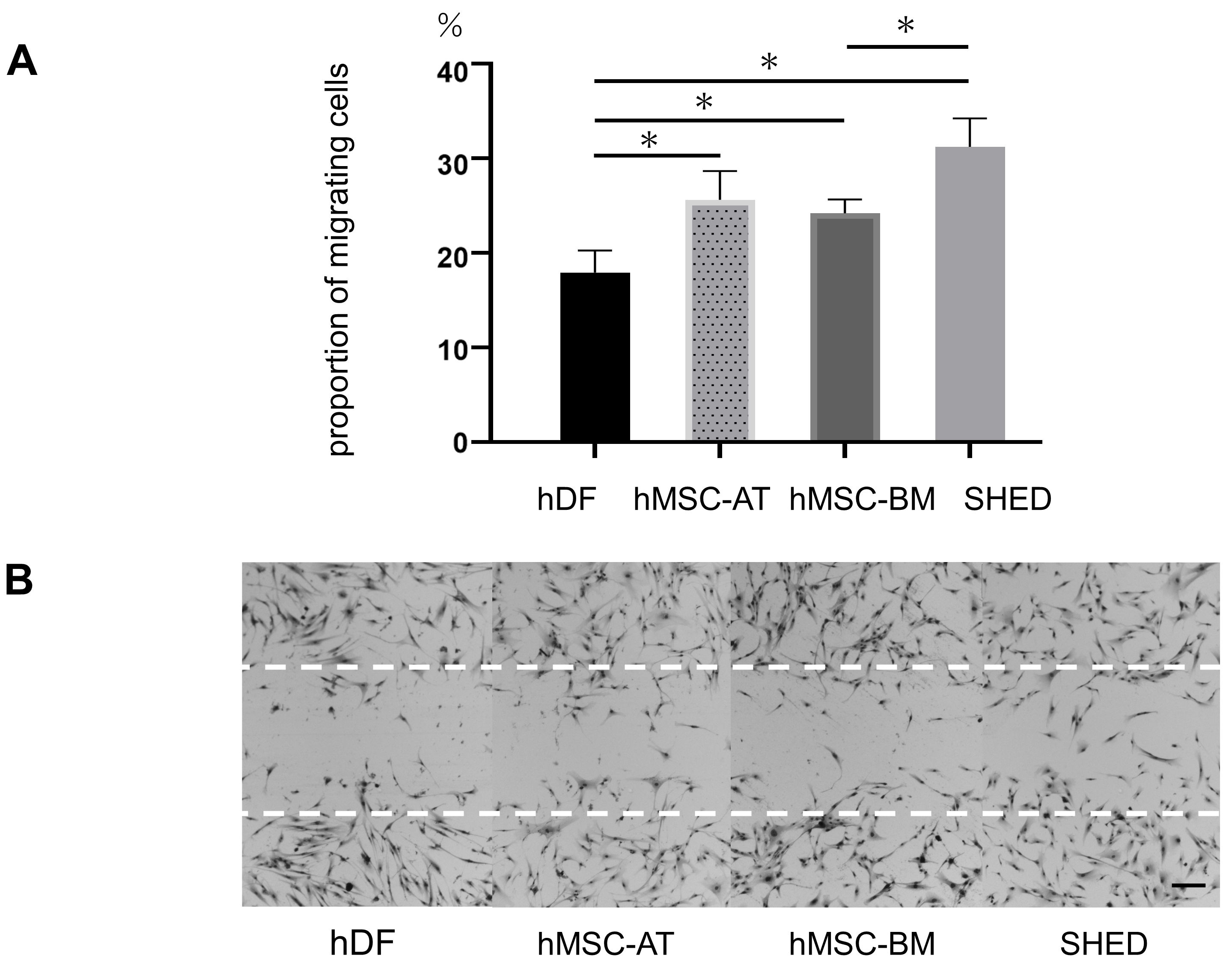 Migration Capacity of Stem Cells from Human Exfoliated Deciduous