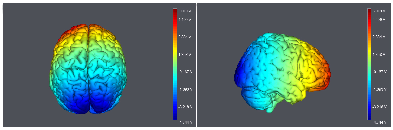 No Frequency-Specific Effect of Transcranial Random Noise Stimulation on  Resting EEG