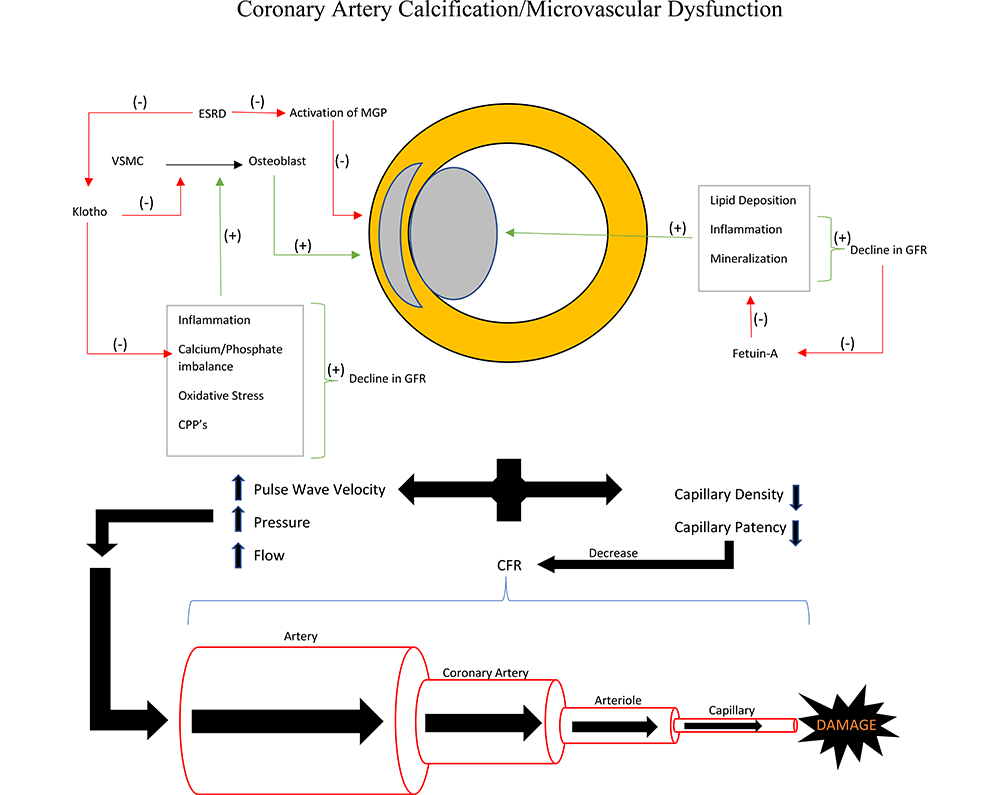 Mechanisms of Myocardial Ischemia in Cancer Patients: A State-of-the-Art  Review of Obstructive Versus Non-Obstructive Causes