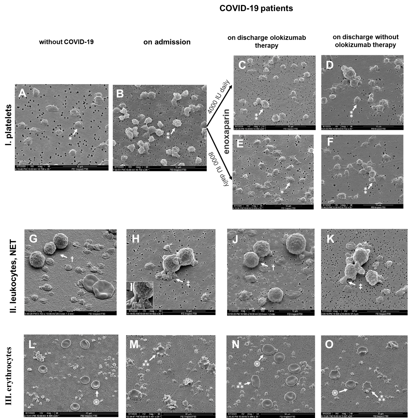 Impact of olokizumab on platelets, leukocytes and erythrocytes during mild COVID19