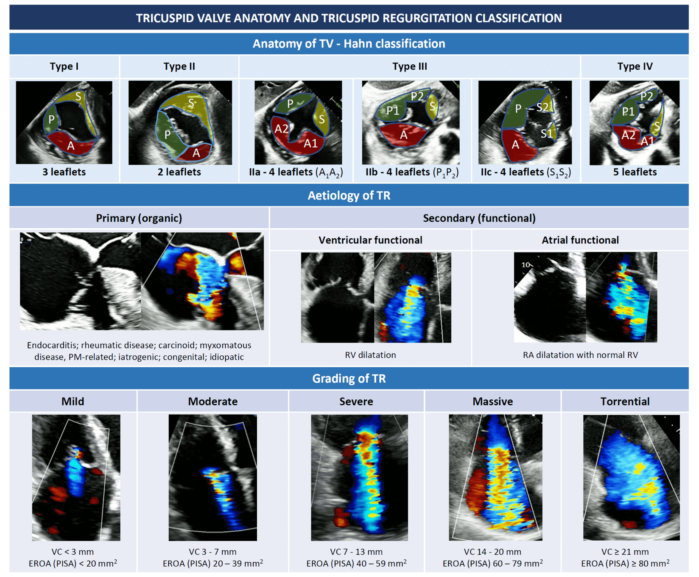 Transthoracic Echocardiographic Images Obtained after Cardiac  Catheterization 